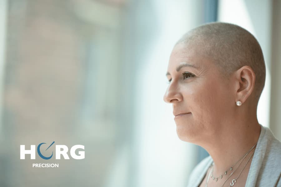 Radiotherapie et perte de cheveux 