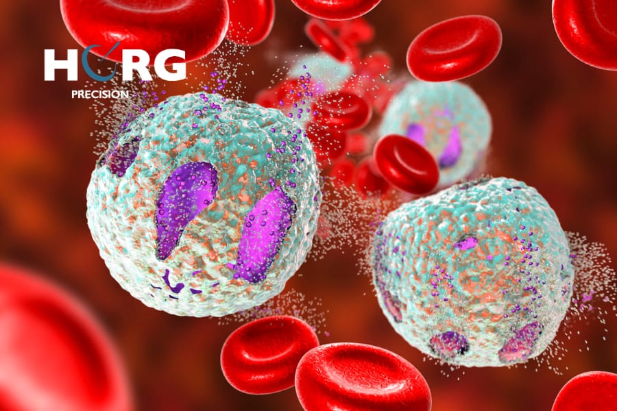 cancer des os metastase