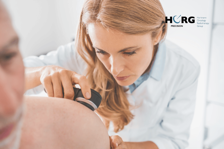 m&eacute;decin diagnostic m&eacute;lanome